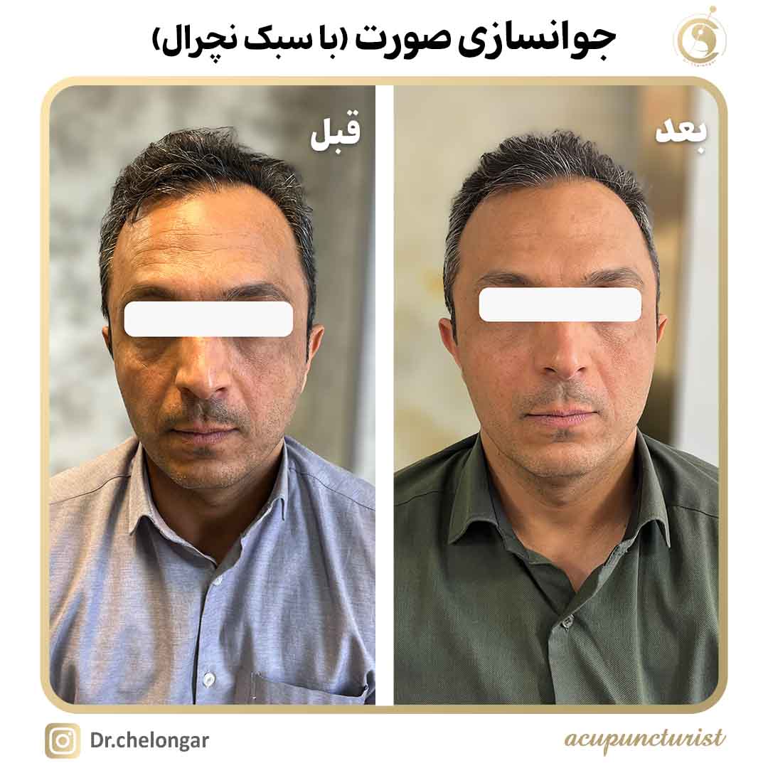 دکتر محمدرضا چلونگر 17 2جوانسازی