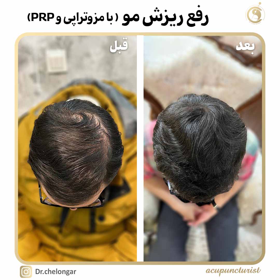 دکتر محمدرضا چلونگر 19 site2ریزش مو